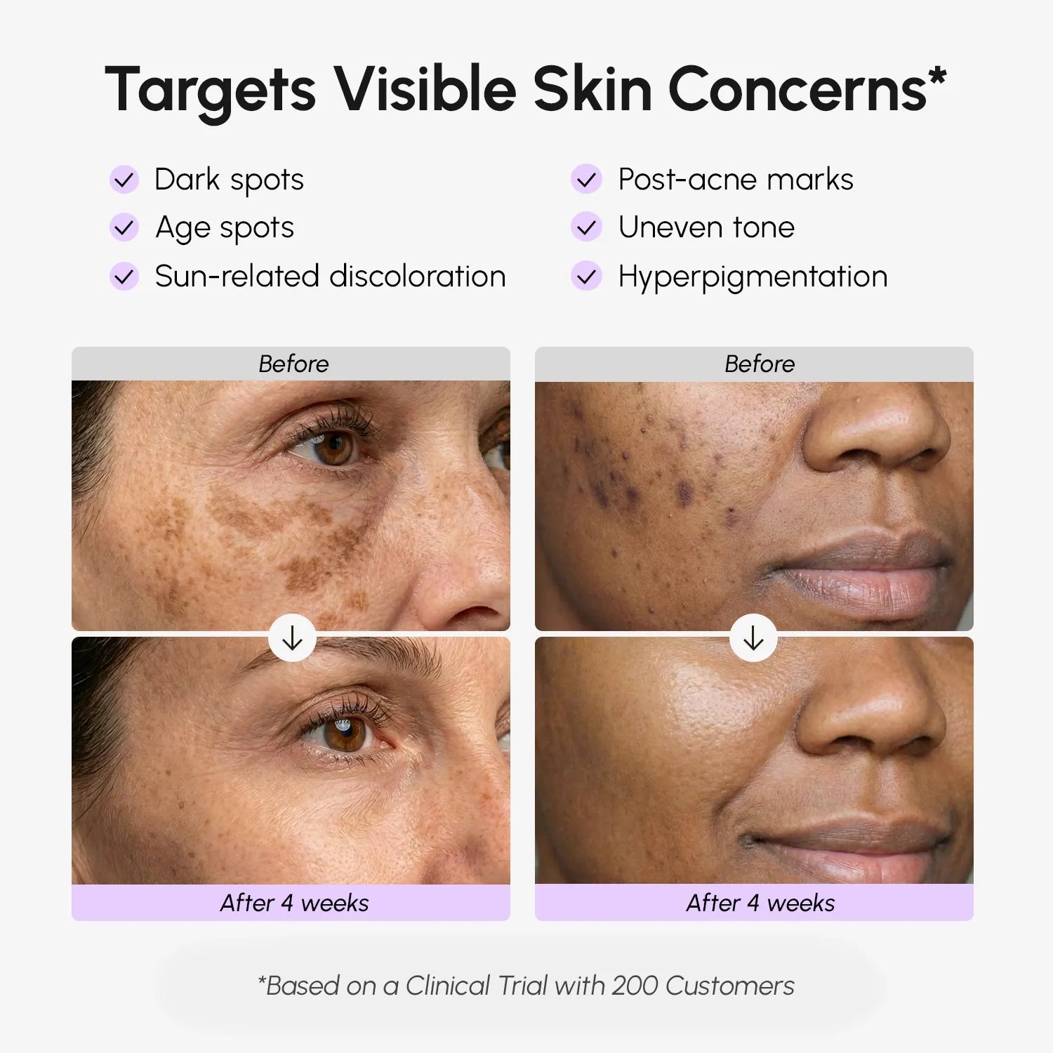 Face &amp; Body Serum for Dark Spots