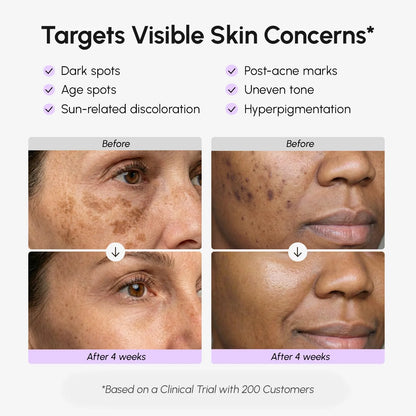 Face &amp; Body Serum for Dark Spots